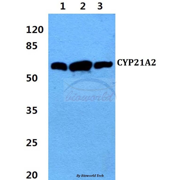 Anti-CYP21A2 (F177) Antibody from Bioworld Technology (BS2189) - Antibodies.com