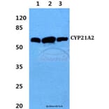 Anti-CYP21A2 (F177) Antibody from Bioworld Technology (BS2189) - Antibodies.com