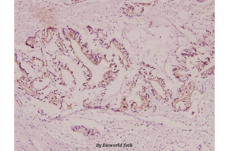 Anti-CYP21A2 (F177) Antibody from Bioworld Technology (BS2189) - Antibodies.com