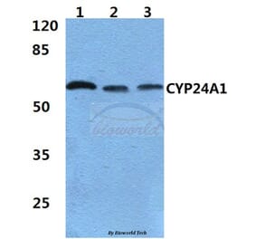 Anti-CYP24A1 (R439) Antibody from Bioworld Technology (BS2190) - Antibodies.com