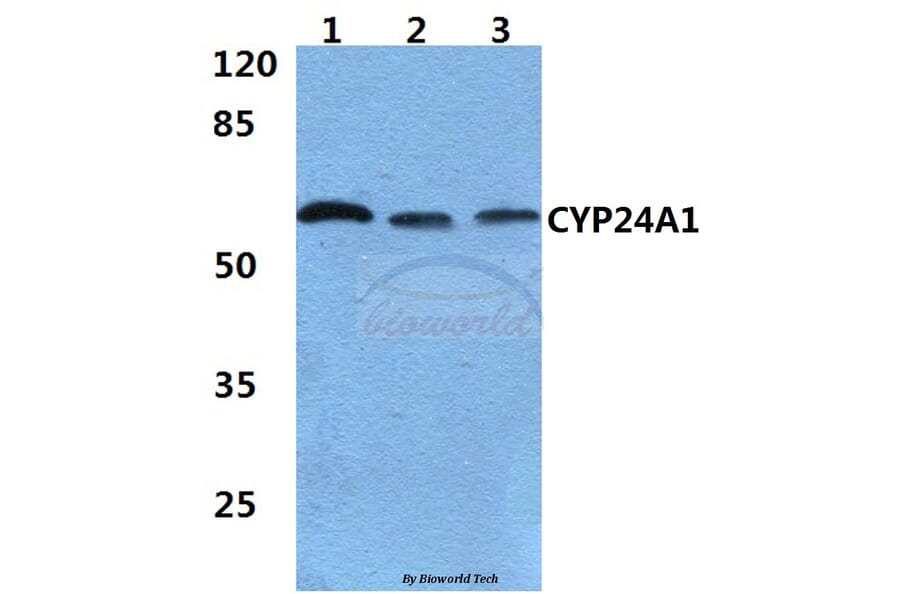 Anti-CYP24A1 (R439) Antibody from Bioworld Technology (BS2190) - Antibodies.com