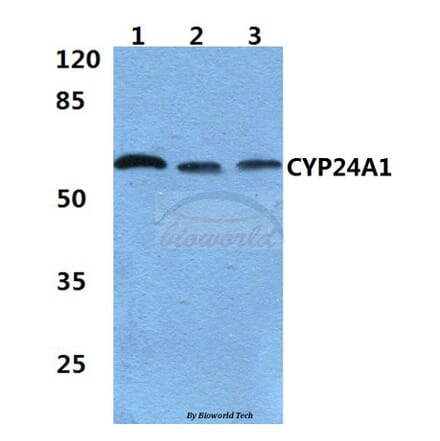 Anti-CYP24A1 (R439) Antibody from Bioworld Technology (BS2190) - Antibodies.com