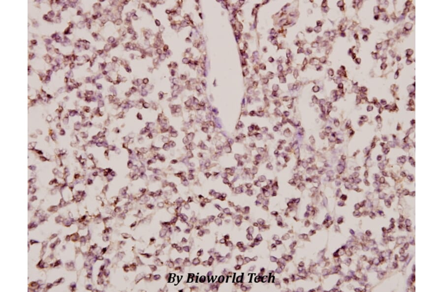 Anti-CYP24A1 (R439) Antibody from Bioworld Technology (BS2190) - Antibodies.com