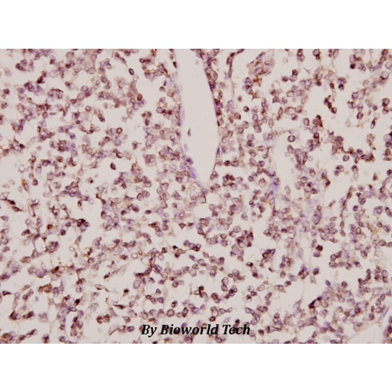 Anti-CYP24A1 (R439) Antibody from Bioworld Technology (BS2190) - Antibodies.com