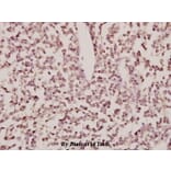 Anti-CYP24A1 (R439) Antibody from Bioworld Technology (BS2190) - Antibodies.com