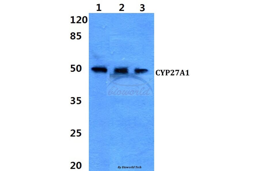 Anti-CYP27A1 (E131) Antibody from Bioworld Technology (BS2192) - Antibodies.com