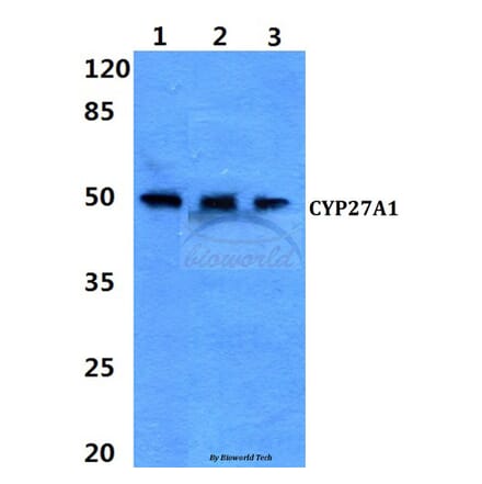 Anti-CYP27A1 (E131) Antibody from Bioworld Technology (BS2192) - Antibodies.com