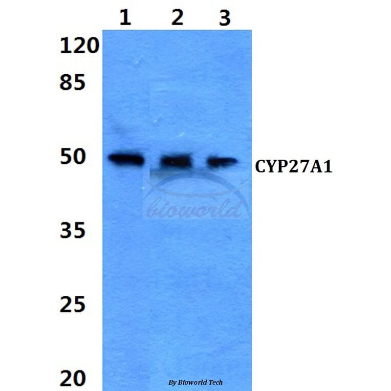 Anti-CYP27A1 (E131) Antibody from Bioworld Technology (BS2192) - Antibodies.com
