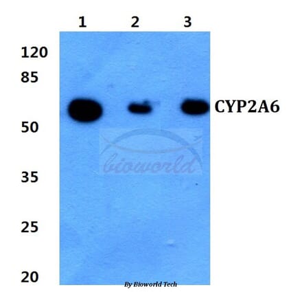 Anti-CYP2A6 (E131) Antibody from Bioworld Technology (BS2193) - Antibodies.com