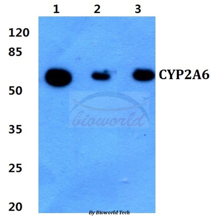 Anti-CYP2A6 (E131) Antibody from Bioworld Technology (BS2193) - Antibodies.com