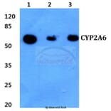 Anti-CYP2A6 (E131) Antibody from Bioworld Technology (BS2193) - Antibodies.com