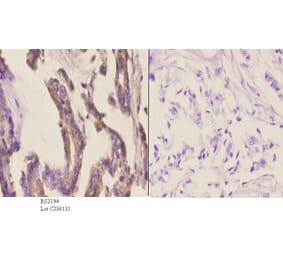 Anti-CYP2A13 (N338) Antibody from Bioworld Technology (BS2194) - Antibodies.com