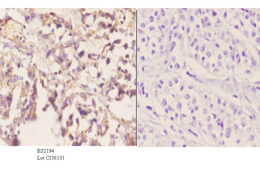 Anti-CYP2A13 (N338) Antibody from Bioworld Technology (BS2194) - Antibodies.com