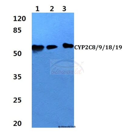 Anti-CYP2C8/9/18/19 (M136) Antibody from Bioworld Technology (BS2195) - Antibodies.com