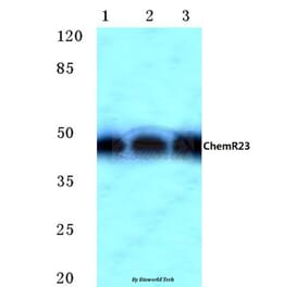 Anti-ChemR23 (R249) Antibody from Bioworld Technology (BS2199) - Antibodies.com