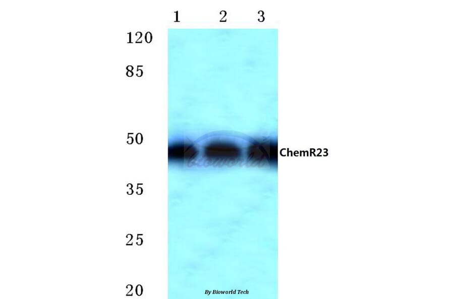 Anti-ChemR23 (R249) Antibody from Bioworld Technology (BS2199) - Antibodies.com