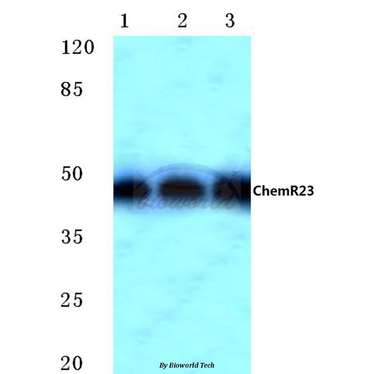 Anti-ChemR23 (R249) Antibody from Bioworld Technology (BS2199) - Antibodies.com