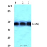 Anti-ChemR23 (R249) Antibody from Bioworld Technology (BS2199) - Antibodies.com