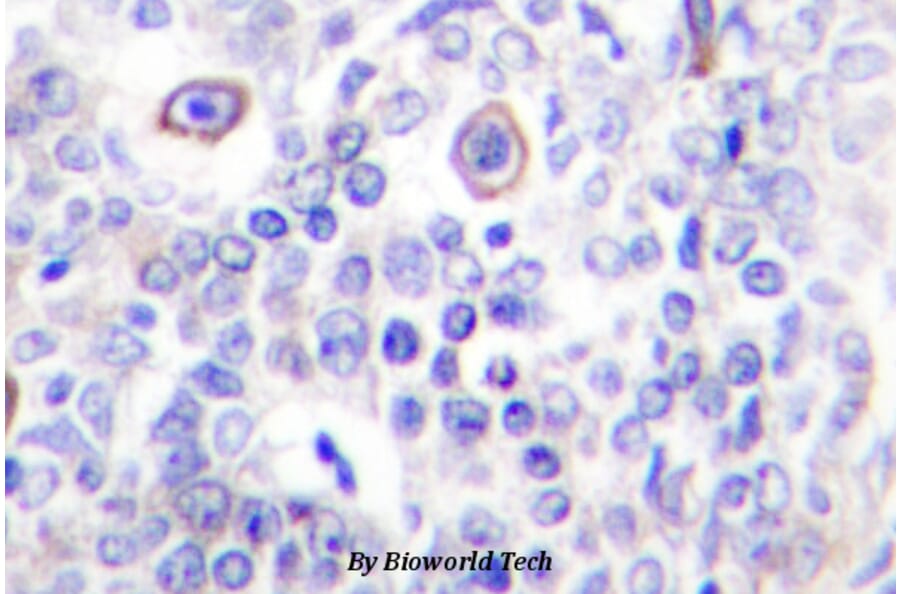 Anti-CD83 (P130) Antibody from Bioworld Technology (BS2204) - Antibodies.com