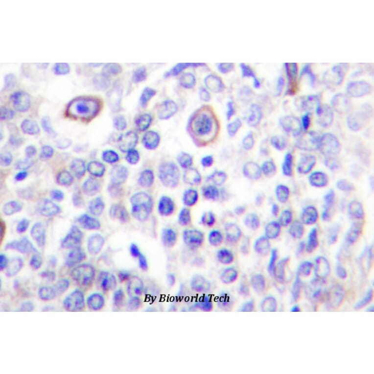 Anti-CD83 (P130) Antibody from Bioworld Technology (BS2204) - Antibodies.com