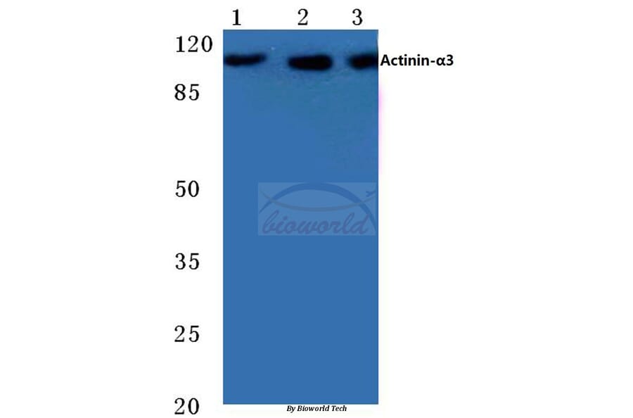 Anti-Actinin-α3 (E25) Antibody from Bioworld Technology (BS2205) - Antibodies.com