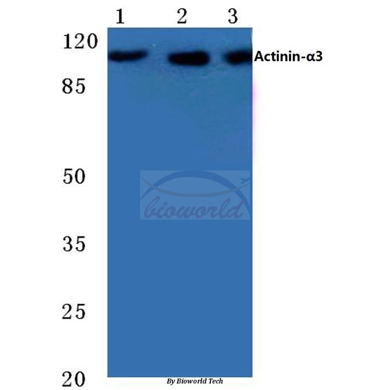 Anti-Actinin-α3 (E25) Antibody from Bioworld Technology (BS2205) - Antibodies.com