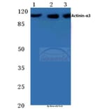 Anti-Actinin-α3 (E25) Antibody from Bioworld Technology (BS2205) - Antibodies.com