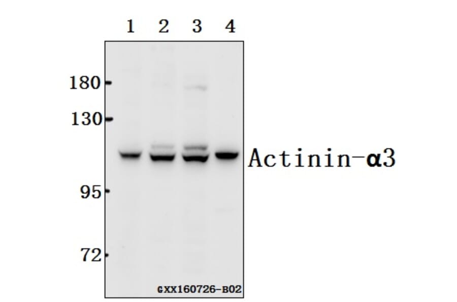 Anti-Actinin-α3 (E25) Antibody from Bioworld Technology (BS2205) - Antibodies.com