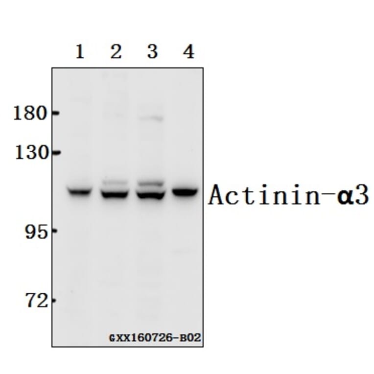Anti-Actinin-α3 (E25) Antibody from Bioworld Technology (BS2205) - Antibodies.com