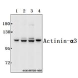 Anti-Actinin-α3 (E25) Antibody from Bioworld Technology (BS2205) - Antibodies.com