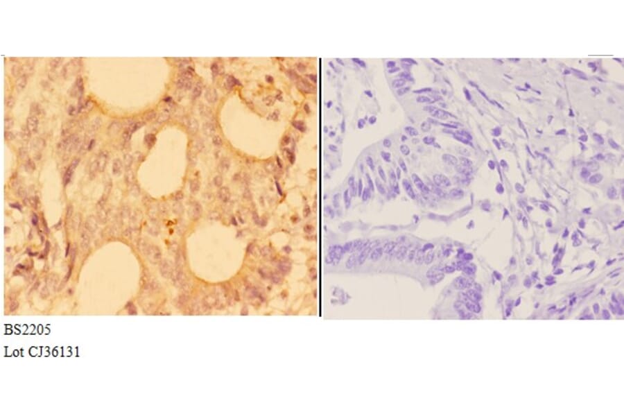 Anti-Actinin-α3 (E25) Antibody from Bioworld Technology (BS2205) - Antibodies.com