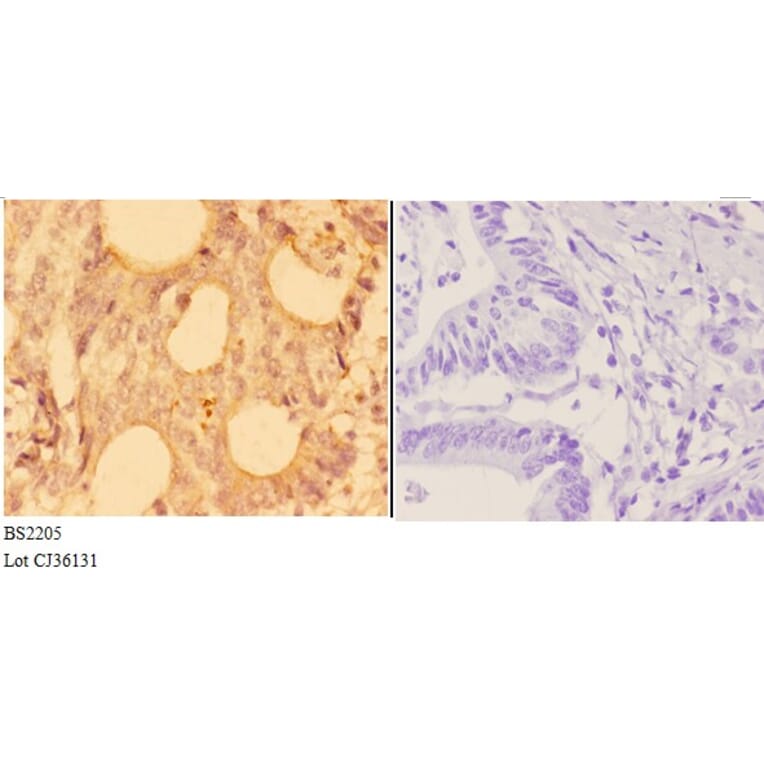Anti-Actinin-α3 (E25) Antibody from Bioworld Technology (BS2205) - Antibodies.com