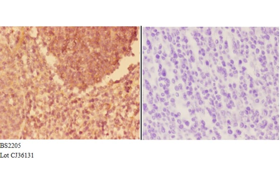 Anti-Actinin-α3 (E25) Antibody from Bioworld Technology (BS2205) - Antibodies.com