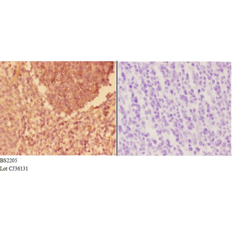 Anti-Actinin-α3 (E25) Antibody from Bioworld Technology (BS2205) - Antibodies.com