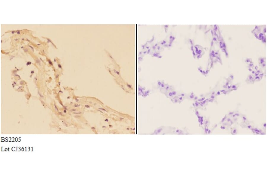Anti-Actinin-α3 (E25) Antibody from Bioworld Technology (BS2205) - Antibodies.com