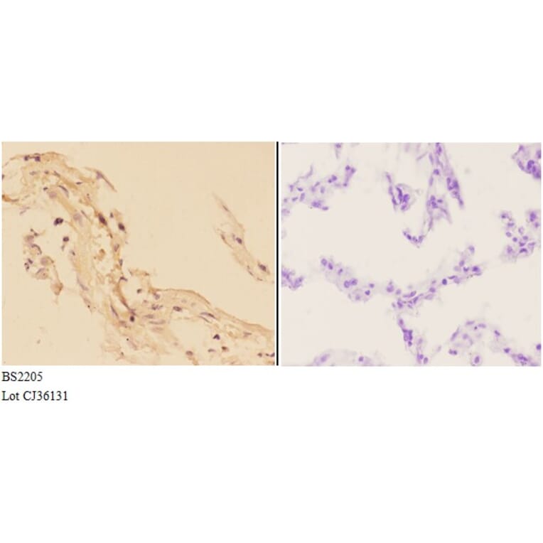 Anti-Actinin-α3 (E25) Antibody from Bioworld Technology (BS2205) - Antibodies.com