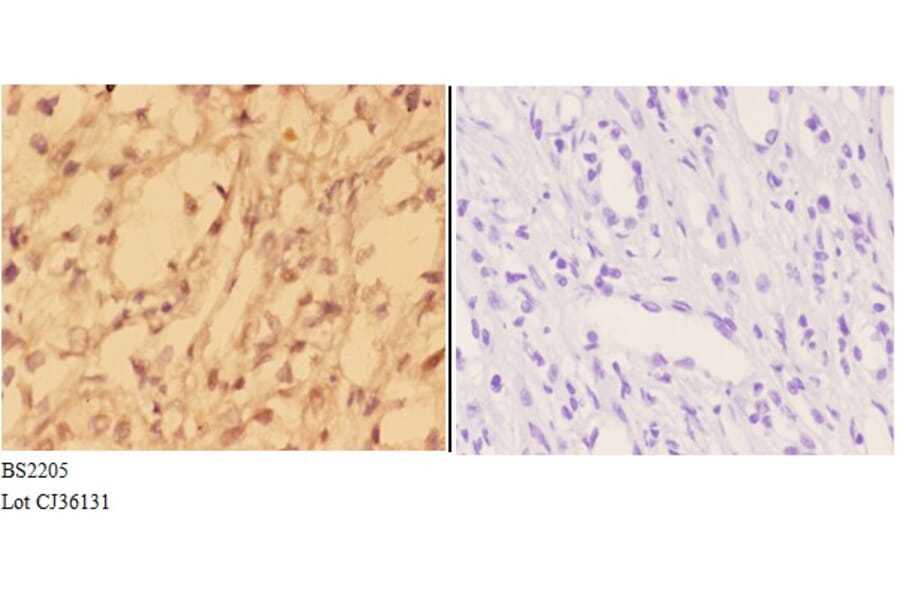 Anti-Actinin-α3 (E25) Antibody from Bioworld Technology (BS2205) - Antibodies.com