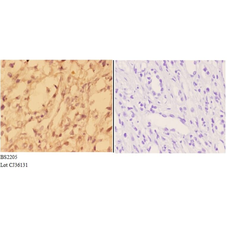 Anti-Actinin-α3 (E25) Antibody from Bioworld Technology (BS2205) - Antibodies.com