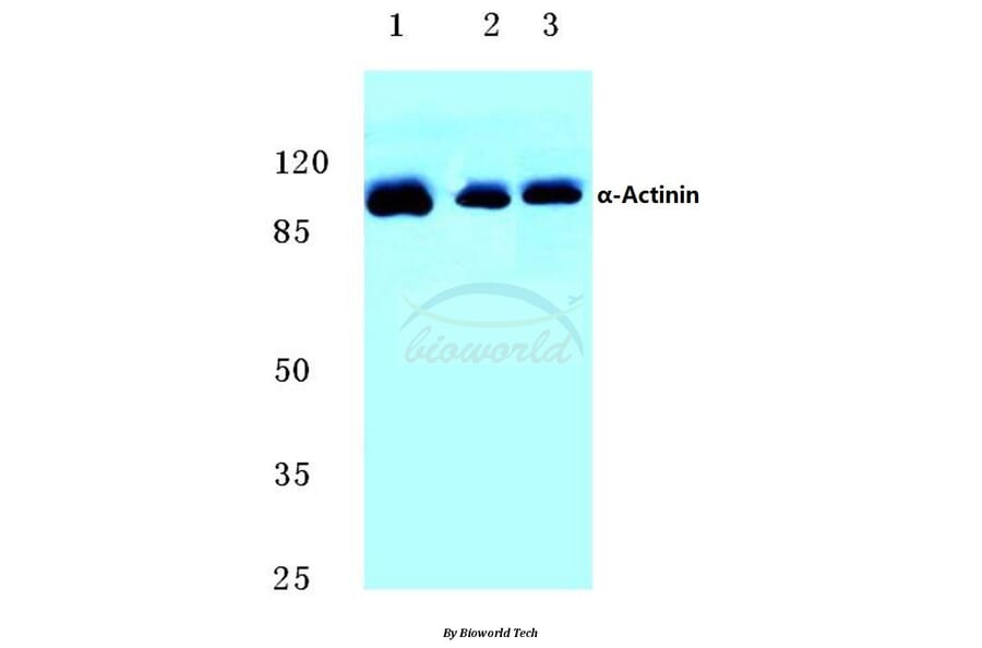 Anti-Actinin-α1/2/3/4 (W48) Antibody from Bioworld Technology (BS2206) - Antibodies.com