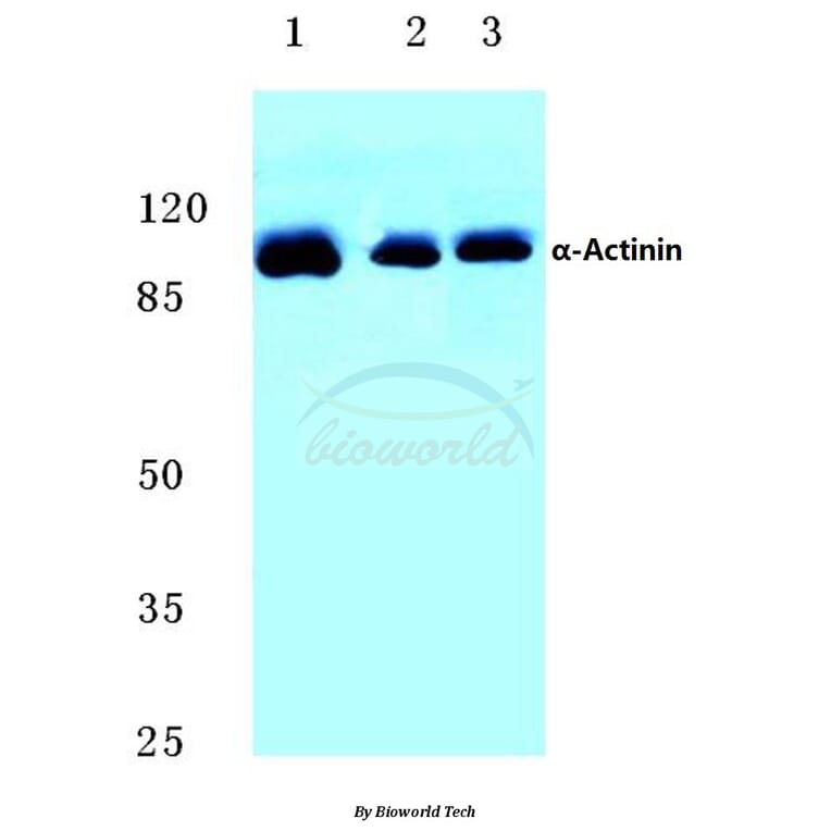 Anti-Actinin-α1/2/3/4 (W48) Antibody from Bioworld Technology (BS2206) - Antibodies.com