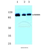 Anti-Actinin-α1/2/3/4 (W48) Antibody from Bioworld Technology (BS2206) - Antibodies.com