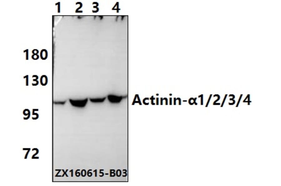 Anti-Actinin-α1/2/3/4 (W48) Antibody from Bioworld Technology (BS2206) - Antibodies.com