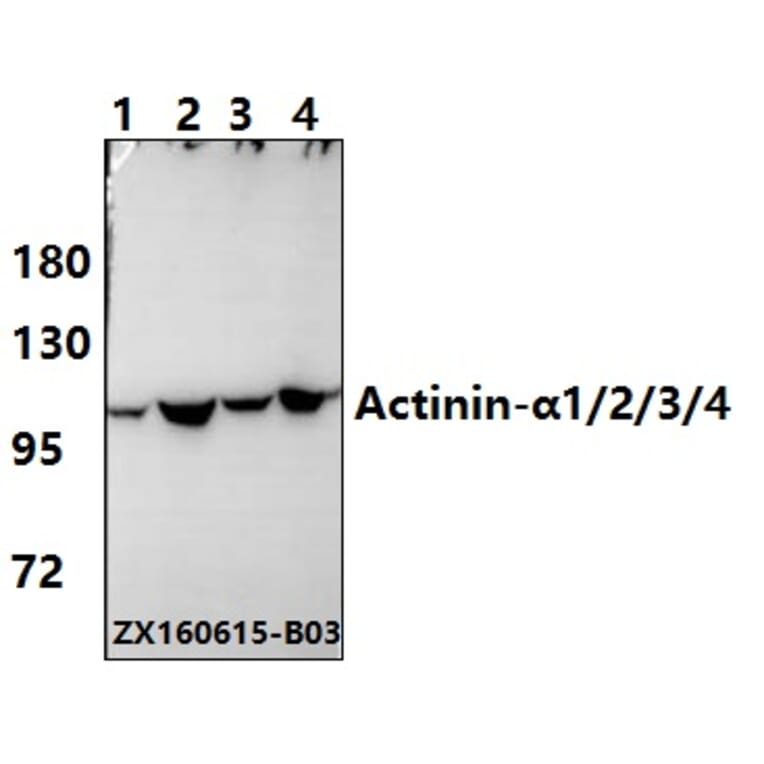 Anti-Actinin-α1/2/3/4 (W48) Antibody from Bioworld Technology (BS2206) - Antibodies.com