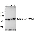 Anti-Actinin-α1/2/3/4 (W48) Antibody from Bioworld Technology (BS2206) - Antibodies.com