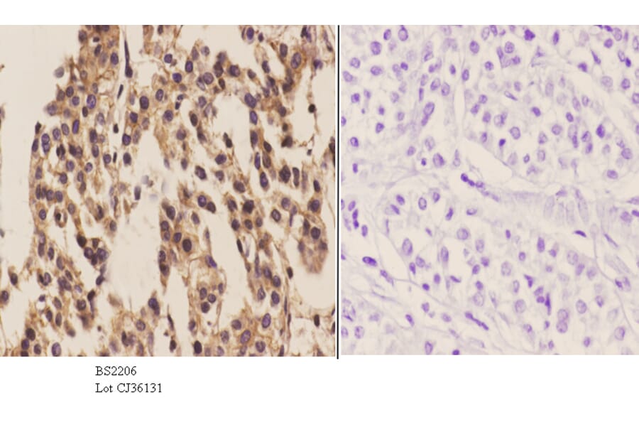 Anti-Actinin-α1/2/3/4 (W48) Antibody from Bioworld Technology (BS2206) - Antibodies.com