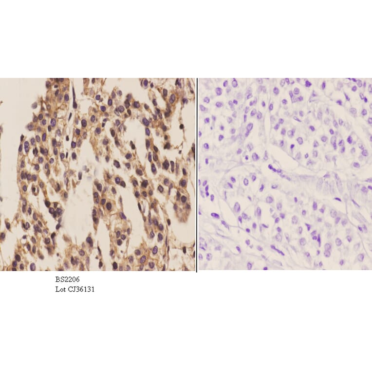 Anti-Actinin-α1/2/3/4 (W48) Antibody from Bioworld Technology (BS2206) - Antibodies.com