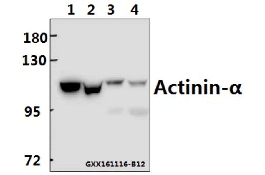 Anti-Actinin-α1/2/3/4 (W48) Antibody from Bioworld Technology (BS2206) - Antibodies.com