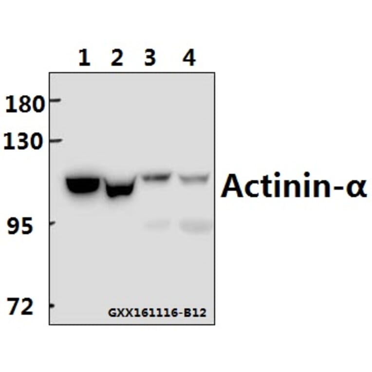 Anti-Actinin-α1/2/3/4 (W48) Antibody from Bioworld Technology (BS2206) - Antibodies.com
