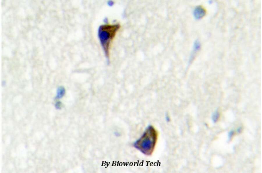 Anti-AR-α1A (Q365) Antibody from Bioworld Technology (BS2207) - Antibodies.com