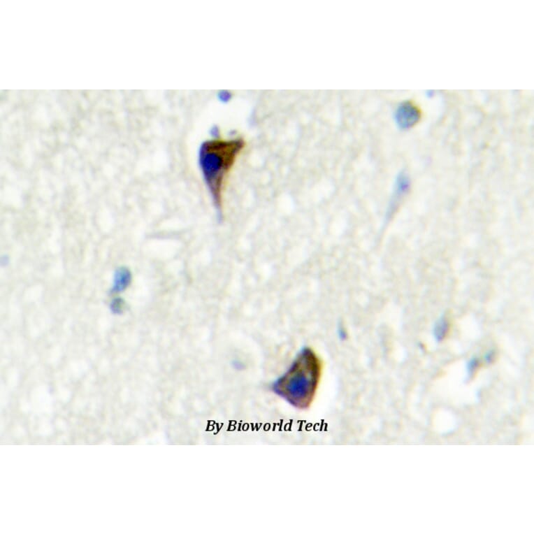 Anti-AR-α1A (Q365) Antibody from Bioworld Technology (BS2207) - Antibodies.com